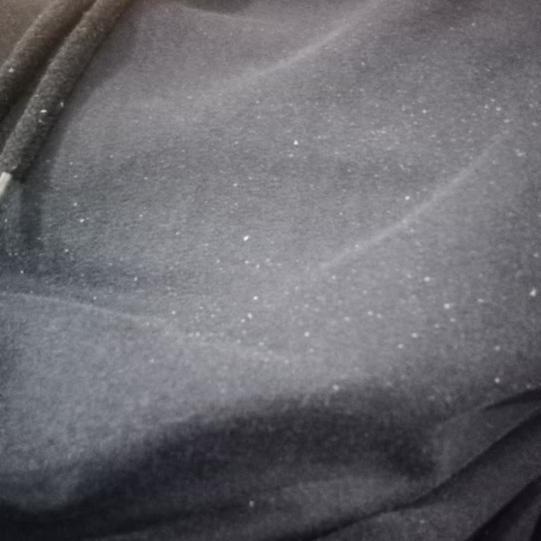 Mehmet Veysel Varır Saçımı Kepek Yapan Sabun Deneyimi