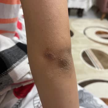 Rönesans Vip Güzellik Salonu Konya Rönesans Vip Şikayet