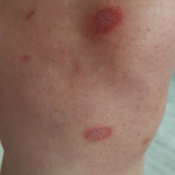 Epilady Kişisel Bakım Salonu Epilady Güzellik Merkezi Sultanbeyli