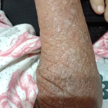 Özel Diva Yaşlı Bakım Merkezi Bakım Değil Bakımsızlık Merkezi!