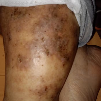 Özel Diva Yaşlı Bakım Merkezi Bakım Değil Bakımsızlık Merkezi!