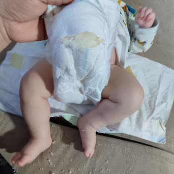 Prima Premium Care Mağduru