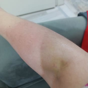 Salihli Devlet Hastanesi Tedavi Gören Annemin Durumu İyi Değil!