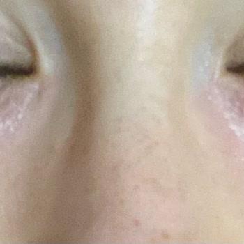 Newgen Kafein + Vitamin C Göz Altı Serumu