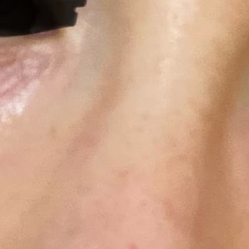 Newgen Kafein + Vitamin C Göz Altı Serumu