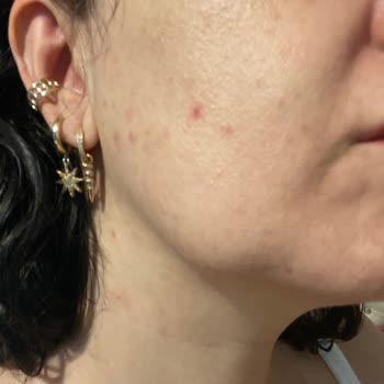 "SHE Vec Glow Me Like You Do" Serum Cildimi Mahvetti Ve Kötü Kokuyor