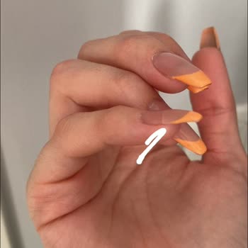 Hol And More Tırnak Şikayeti!