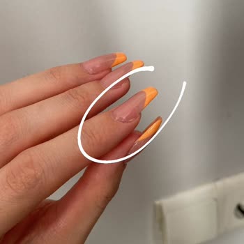 Hol And More Tırnak Şikayeti!