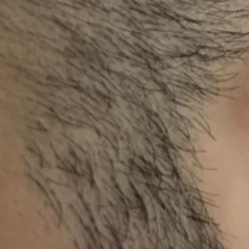 Love Beauty Center Cilt Bakımı Yanlış Uygulama