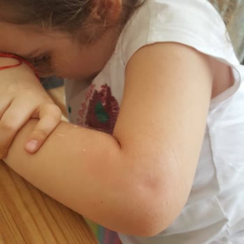 Hupalupa İsimli Organizasyon Şirketi Çocuğumun Durumuyla İlgilenmedi.