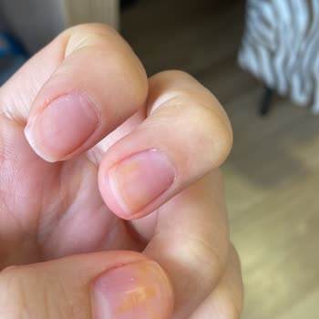 Flormar Oje Turuncu Leke Yaptı