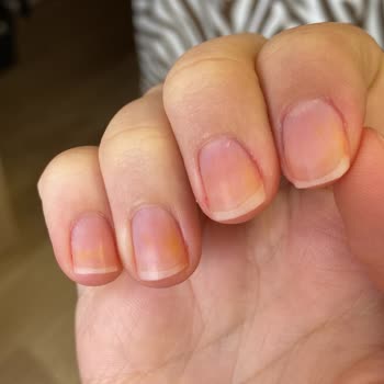 Flormar Oje Turuncu Leke Yaptı