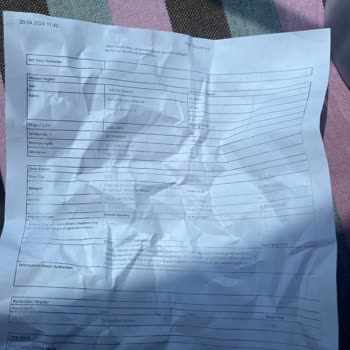 Dyson V15 Beni Çok Üzdü