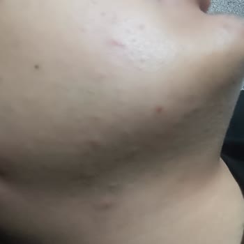 Jeuvenile Üründen Hiç Memnun Kalmadım Bir An Önce İademin Kabul Edilmesini