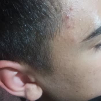 Jeuvenile Üründen Hiç Memnun Kalmadım Bir An Önce İademin Kabul Edilmesini