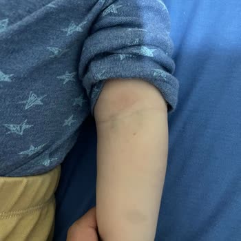 Medicana Hospitals Bebek Acilinde Yaşanan Tıbbi İhmal Ve İlgisizlik