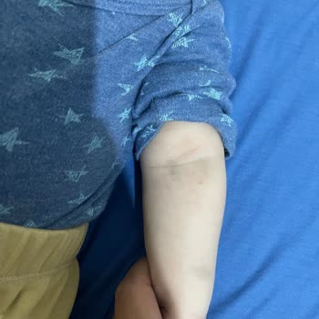 Medicana Hospitals Bebek Acilinde Yaşanan Tıbbi İhmal Ve İlgisizlik