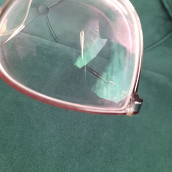 Osse Çerçevem Hemen Kırıldı