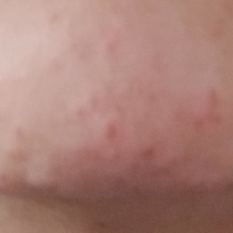 Luxe Vip Güzellik Estetik Kötü Lazer Yapan Eleman