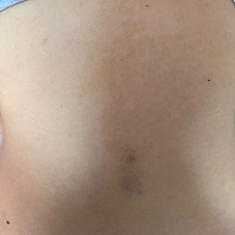 Çorlu Devlet Hastanesi Doğum Servisi Deneyimim