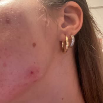 Eve Shop Celenes Nemlendirici Yüzümü Mahvetti