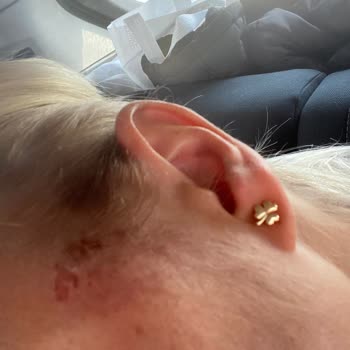 Kuaför Efe (Konya) Açıcıdan Yanan Yüzüm Ve İlgisiz Kuafor