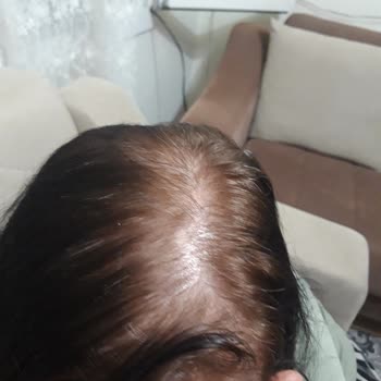 BİM Beklenmedik Sonuç: Siyah Boya Yerine Sarı