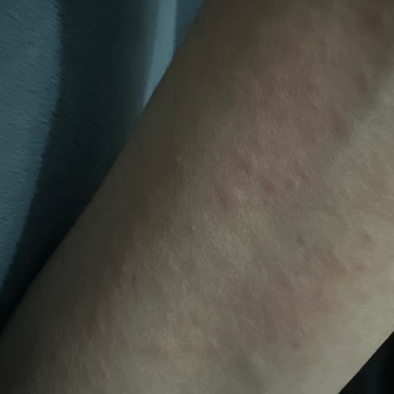Mustela Çatlak Kremi Hamilelik