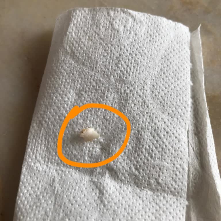 Migros Uzman Kasap Dana Kuzu Kebaptan Kemik Parçası Çıktı