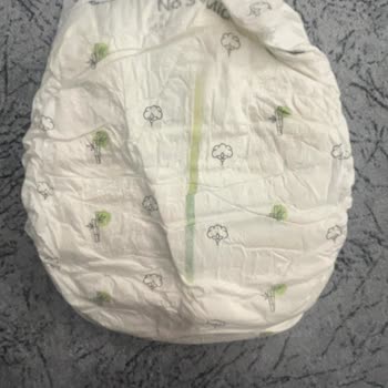 Sleepy Kalitesiz Bebek Bezi Hayal Kırıklığı Yarattı