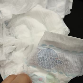 Molfix Bebek Bezi Yabancı Madde