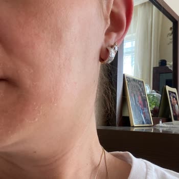 Loreal Paris L'Oreal Paris Gece Serumu Yüzümü Yaktı