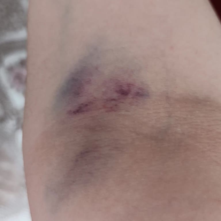 Karabük Eğitim Ve Araştırma Hastanesi Böyle Hastane Olmaz