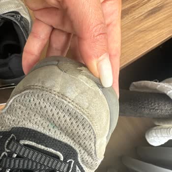 Skechers Çocuk Ayakkabısı 4 Günde Ön Üç Kısımları Açıldı.