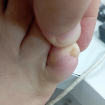 SuperStep Manisa Mağazasından Puma Ayakkabı Aldım Giyemiyorum