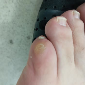 SuperStep Manisa Mağazasından Puma Ayakkabı Aldım Giyemiyorum