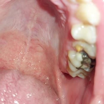 Domino's Pizzadan Dişim Kırıldı