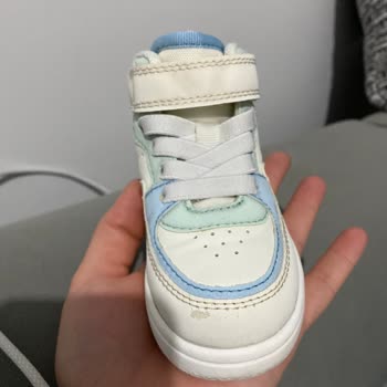 HM Ayakkabı Derisinde Soyulma Meydana Geldi