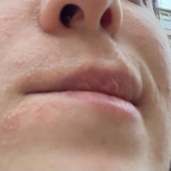 The Purest Solutions The Purest Solution Aydınlatıcı C Vitamini Yüzümü Yaktı!