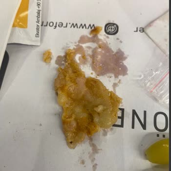 Reform Döner'de Yaşadığım Kötü Olay