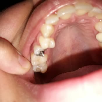 Kellogg's Coco Pops Sertliği Dişimi Kırdı!