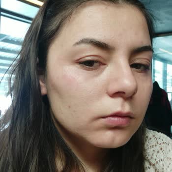 Maruderm Salisilik Asit Yüz Yıkama Jeli Tahriş Ediyor