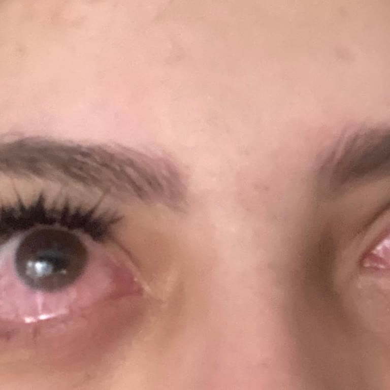 Saloons Güzellik Salonu İpek Kirpik Faciası Ve İşletmenin Hatasını Kabul Etmemesi