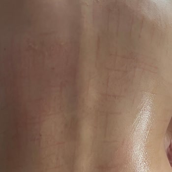 Alen Güzellik Ve Yaşam Merkezi'nde Yandım