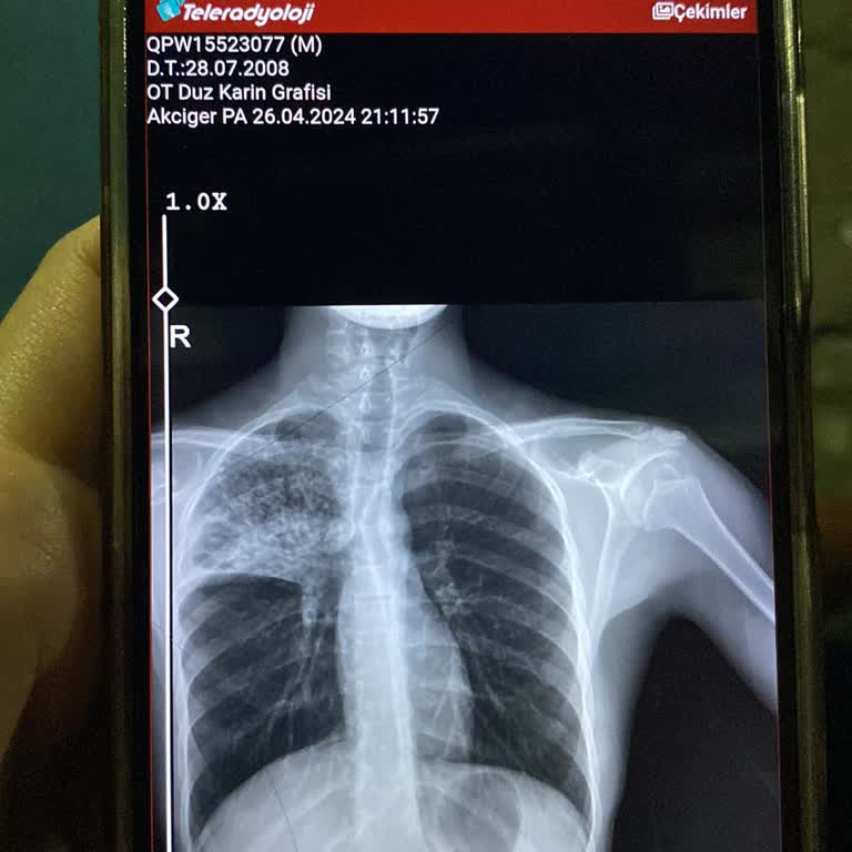 Topkapı Okulları Kış Boyunca Isınma Sorunu Ve Çocuğumun Sağlığı