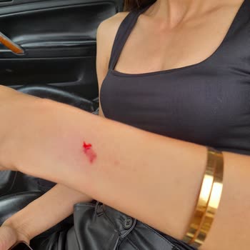 Altın Koru Kır Bahçeleri & Tarihi Konak Restoran Saldırı Ve Darp