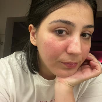 Yves Rocher Krem Suratımızı Mahvetti.