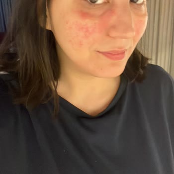 Yves Rocher Krem Suratımızı Mahvetti.