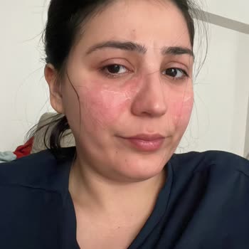 Yves Rocher Krem Suratımızı Mahvetti.