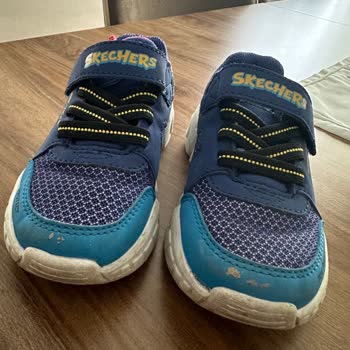 Skechers Deri Dökülmesi/Soyulması Hakkında